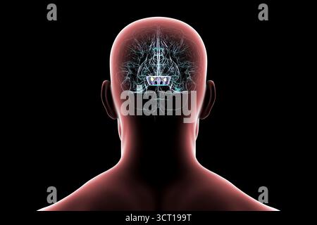 Illustration eines menschlichen Gehirns mit degenerierter Substantia nigra bei Morbus Parkinson, der Verlust pigmentierter Nervenzellen im Mittelhirn im Zusammenhang mit motorischer Dysfunktion zeigt. Stockfoto