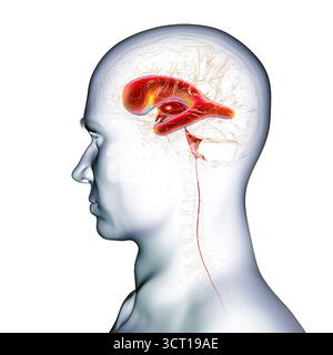 Darstellung eines menschlichen Gehirns mit Normaldruckhydrozephalus. Dies ist eine Erkrankung bei älteren Erwachsenen, bei der sich Zerebrospinalflüssigkeit (CSF) in den Ventrikeln des Gehirns ansammelt, was vergrößerte Ventrikel und eine Kompression des Hirngewebes verursacht. Stockfoto