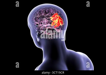 Illustration eines menschlichen Gehirns mit hervorgehobenem Precuneus gyrus. Diese Region war an Gedächtnis, Selbstwahrnehmung und visueller Verarbeitung beteiligt. Stockfoto