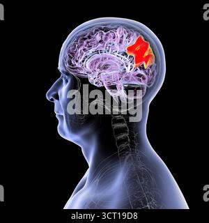 Illustration eines menschlichen Gehirns mit hervorgehobenem Precuneus gyrus. Diese Region war an Gedächtnis, Selbstwahrnehmung und visueller Verarbeitung beteiligt. Stockfoto