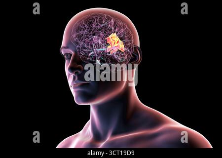 Illustration eines menschlichen Gehirns mit hervorgehobenem Precuneus gyrus. Diese Region war an Gedächtnis, Selbstwahrnehmung und visueller Verarbeitung beteiligt. Stockfoto