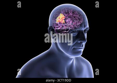 Illustration eines menschlichen Gehirns mit hervorgehobenem Precuneus gyrus. Diese Region war an Gedächtnis, Selbstwahrnehmung und visueller Verarbeitung beteiligt. Stockfoto