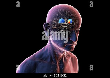 Abbildung eines älteren menschlichen Gehirns mit hervorgehobenem Putamen (blau) und Globus pallidus (gelb), die basale Ganglienstrukturen zeigen, die für die motorische Kontrolle von entscheidender Bedeutung sind und bei Bewegungsstörungen beeinflusst werden. Stockfoto