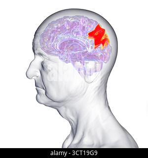 Illustration eines älteren menschlichen Gehirns mit hervorgehobenem Precuneus gyrus. Diese Region ist an Gedächtnis, Selbstwahrnehmung und visuell-räumlicher Verarbeitung beteiligt und wird frühzeitig bei Alzheimer beeinflusst. Stockfoto