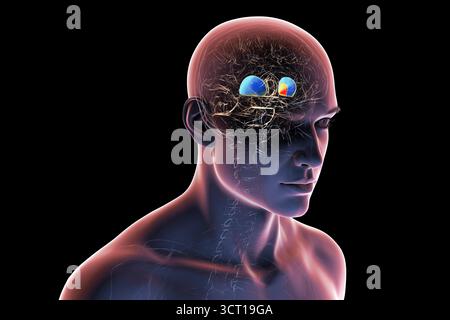 Abbildung eines menschlichen Gehirns mit hervorgehobenem Putamen (blau) und Globus pallidus (gelb), die basale Ganglienstrukturen zeigen, die für die motorische Kontrolle von entscheidender Bedeutung sind und bei Bewegungsstörungen betroffen sind. Stockfoto
