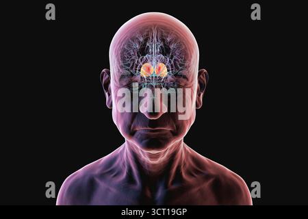 Abbildung des menschlichen Gehirns einer älteren Person mit hervorgehobenem Thalamus (rot), zeigt die gepaarten Strukturen der tiefen grauen Substanz, die sensorische und motorische Signale an die Großhirnrinde weiterleiten. Vorderansicht. Stockfoto
