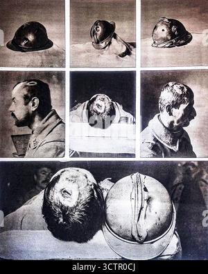 Seite aus Le Miroir, 30. Januar 1916, zeigt französische Soldaten, deren Leben durch den Adrian-Stahlhelm gerettet wurden. Die Bilder zeigen beschädigte Helme, die von Kugeln und Schrapnell getroffen wurden, sowie Porträts der überlebenden Männer. Der 1915 eingeführte Adrian-Helm reduzierte Kopfverletzungen an der Westfront erheblich. Diese Funktion hebt sowohl das Trauma auf dem Schlachtfeld als auch die lebensrettende Rolle neuer militärischer Schutzausrüstung während des Ersten Weltkriegs hervor Stockfoto