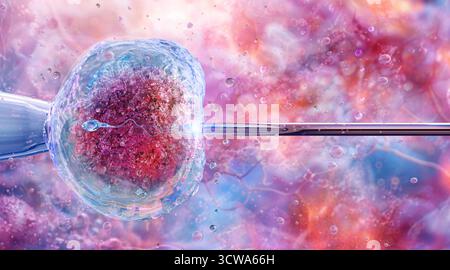 Abbildung des Prozesses der künstlichen Besamung oder der in-vitro-Fertilisation (IVF). Eine Spermienzelle wird unter Laborbedingungen mit Hilfe eines Mikronadels direkt in eine menschliche Eizelle injiziert. Stockfoto
