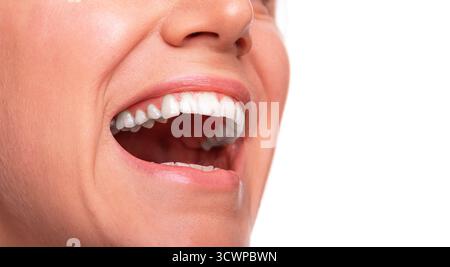 Mund und Nase einer Person, weit offen im Lachen, mit gesunden, weißen Zähnen vor einem hellen, weißen Hintergrund. Stockfoto
