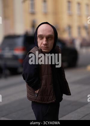 Mann mit Zwergwuchs, der auf der Straße steht und nachdenklich wegschaut. Kapuze oben, legere Weste, einzigartige Person, die ruhige Besinnung in urbanem Setting ausdrückt Stockfoto