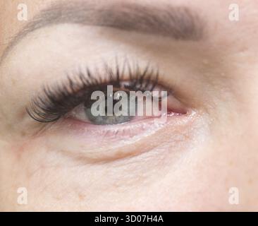 Nahaufnahme einer irritierten roten Augen Stockfoto