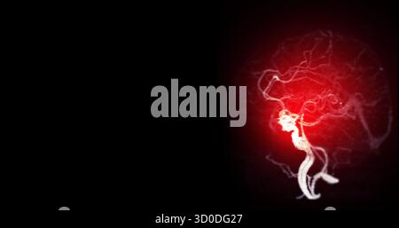 CTA Brain Vascular Imaging ( CTA Brain Vascular Imaging ) zeigt einen detaillierten 3D CTA Scan des Gefäßnetzes des Gehirns, der eine klare Darstellung der Arterien und des Blutflusses zeigt Stockfoto