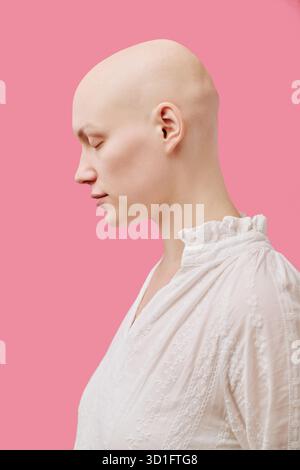 Junge Erwachsene Frau mit Alopezie im Profil vor rosafarbenem Hintergrund Stockfoto