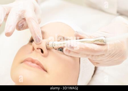 Mikrodermbration Kosmetologie Behandlung. Gesichtsdiamantpeeling. Anti-Akne Stockfoto