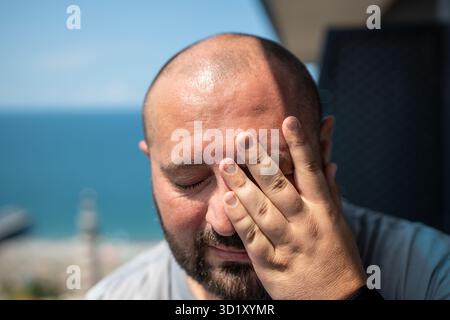 Porträt eines übergewichtigen Mannes mit Hyperhidrose, hohem Schwitzen bei sommerlichem heißem Wetter. Stockfoto