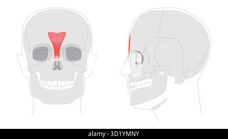 Procerus - Nasenmuskel im Anatomiediagramm dargestellt, verantwortlich für das Zeichnen der Haut zwischen den Augenbrauen nach unten, Ausdruck der runzelnden medizinischen Referenz und pädagogischen Illustration. Stock Vektor