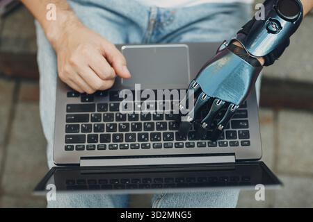 Junger behinderter Mann mit künstlicher prothetischer Hand mit der Eingabe auf Laptop-Computer Tastatur Tasten Tap Push Stockfoto
