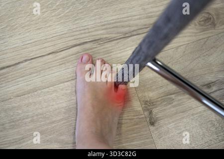 Frau schlug Möbel mit dem kleinen Zeh. Unfall zu Hause. Verletzung des Fusskleinfingers Stockfoto