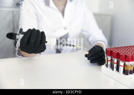 Hände eines Labortechnikers mit einem Röhrchen Blutprobe und Rack mit anderen Proben. Labortechniker, der die Blutröhrchen für die Studie hält Stockfoto
