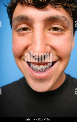 Eine Nahaufnahme eines lächelnden jungen Mannes mit Zahnspangen, der selbstbewusst vor einem leuchtend blauen Hintergrund steht und einen fröhlichen Ausdruck und ein Zahnauto zeigt Stockfoto