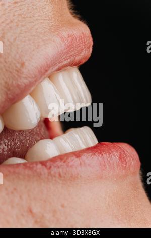 Seitenansicht eines Reifen Frauenlächelns mit weißem Porzellanfurnier und natürlichen Lippen Stockfoto