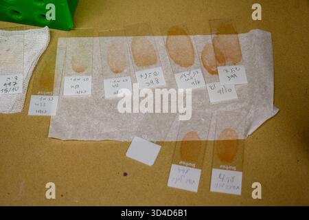 Beschriftete Mikroskop-Objektträger mit Blutproben von hospitalisierten Vögeln zur Analyse, fotografiert im israelischen Wildlife Hospital, Ramat Gan, Stockfoto