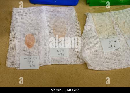 Beschriftete Mikroskop-Objektträger mit Blutproben von hospitalisierten Vögeln zur Analyse, fotografiert im israelischen Wildlife Hospital, Ramat Gan, Stockfoto