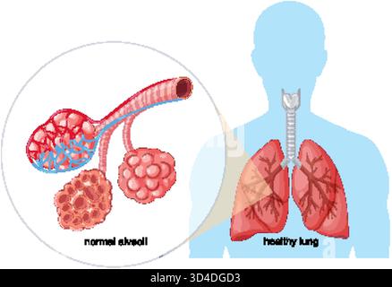 Vektordiagramm, das gesunde menschliche Lunge und detaillierte normale Alveolstruktur mit klarer Markierung zeigt Stock Vektor