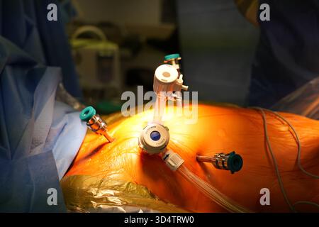 Berlin, Deutschland. November 2025. Mediziner operieren am Herzen eines Patienten mit dem ersten chirurgischen Roboter in der Herzchirurgie am Deutschen Herzzentrum der Charité in Berlin. Quelle: Manuel Genolet/dpa/Alamy Live News Stockfoto