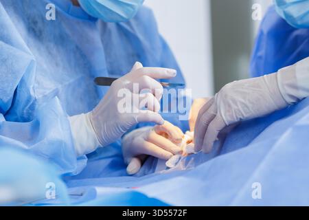 Nahaufnahme der chirurgischen Hände mit Skalpell mit vorsichtiger Inzision bei steriler Krankenhausoperation mit Assistentin Stockfoto