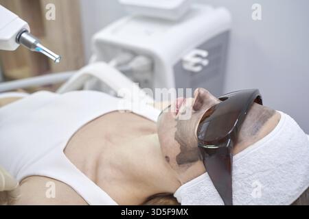 Asiatische Frau mit Laserhautbehandlung in der Klinik mit Schutzbrille und Kohlemaske Stockfoto