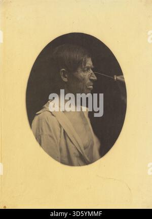 Eine Studie von Duchenne von 1854 bis 1856 über schlechten Humor oder Misszufriedenheit. Die Gravur konzentriert sich auf Gesichtsausdrücke, einschließlich Stirnrunzeln, Augenkontraktion und Lippenpositionierung, um emotionale und muskuläre Reaktionen zu veranschaulichen. Stockfoto