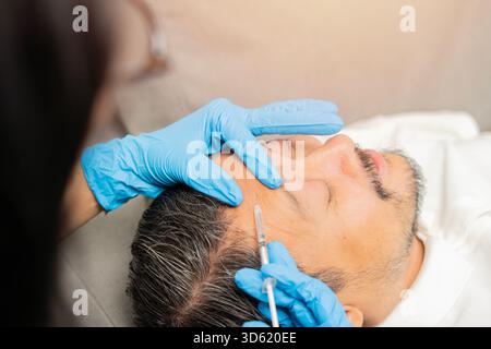 Gutaussehender, mittelalter bärtiger Mann bekommt eine verjüngende Gesichtsspritze in der Schönheitsklinik. Schulteraufnahme, selektiver Fokus. Stockfoto