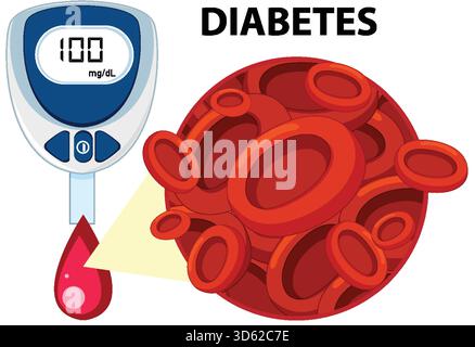 Vektorillustration von Blutzuckermessgerät und vergrößerten roten Blutkörperchen für das Diabetesmonitoring. Stock Vektor