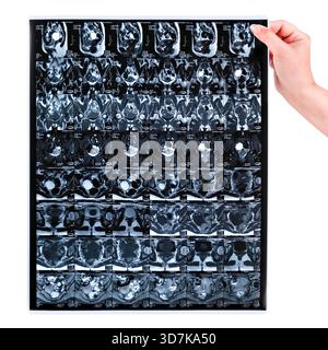Weibliche Hand, die MRT-Scan des Beckens auf weißem Hintergrund hält. Stockfoto