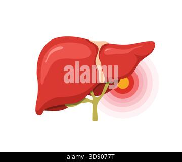 Leberschmerzen. Medizinische Illustration der menschlichen Leberanatomie. Symbole für Krankheitsbehandlung und Gesundheitswesen. Vektordesign Stock Vektor