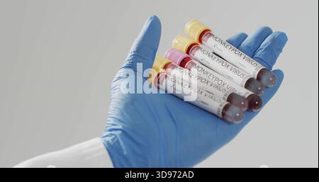 Die Hand mit blauem Nitrilhandschuh halten und fünf mit MONKEYPOXVIRUS gekennzeichnete Blutröhrchen im Labor präsentieren Stockfoto