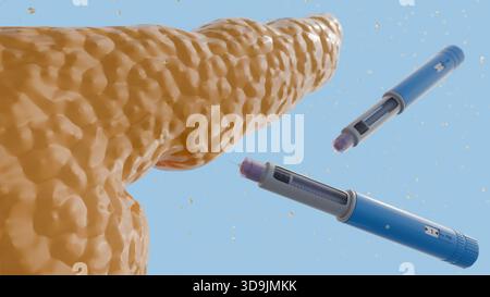 Ein 3D-Rendering der menschlichen Bauchspeicheldrüse und mehrerer blauer und violetter Autoinjektor-Pens, die häufig für die Insulinverabreichung bei Menschen mit Diabetes verwendet werden. Stockfoto