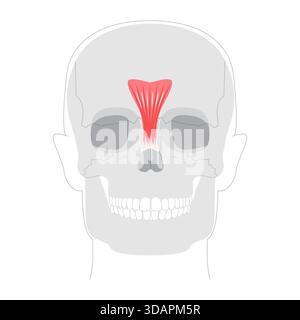 Procerus - Nasenmuskel im Anatomiediagramm dargestellt, verantwortlich für das Zeichnen der Haut zwischen den Augenbrauen nach unten, Ausdruck der runzelnden medizinischen Referenz und pädagogischen Illustration. Stock Vektor