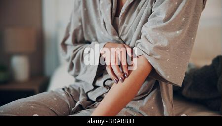 Kratzer, Haut und Stress im Schlafzimmer, in den Händen und im Bewältigungsmechanismus für Angst, Unwohlsein und zu Hause. Juckreiz, Arm und Person mit OCD-Symptomen Stockfoto