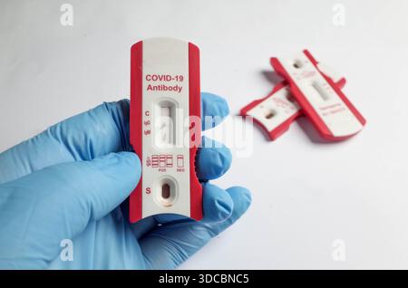 Makrofoto des Covid-19-Antikörpertestkits Stockfoto
