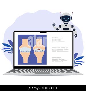 Roboter mit medizinischer Illustration der Kniegelenkanatomie auf Laptop-Bildschirm, geeignet für Bildungsvektor Stock Vektor