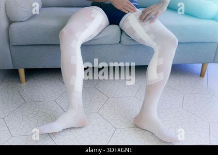 Männliche Beine, die entlang der Vena saphena bandiert sind und weiße Kompressionsbekleidung und Strumpfhosen tragen, werden nach der Operation von einem Chirurgen in einem Krankenhaus untersucht. Stockfoto