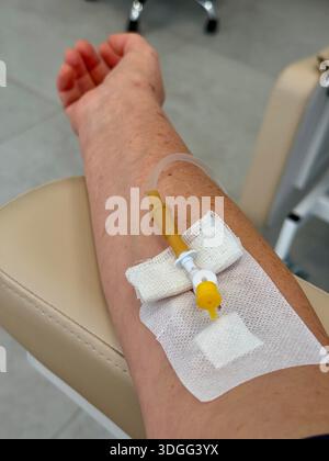 Naharm einer Patientin mit intravenösem Injektionskatheter, die Arzneimittel erhält Stockfoto