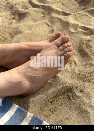 Nahaufnahme von weiblichen Füßen am Sandstrand mit beschädigtem Zehennagel. Konzept der Fußgesundheit, Nagelproblem, Hautpflege, medizinischer Zustand und persönliche Hygie Stockfoto