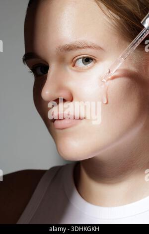 Vertikale Nahaufnahme einer jungen Frau, die Gesichtsserum mit Tropfer aufträgt, mit Akne und Makeln. Geeignet für Dermatologie Hautpflege Website, Banner oder Stockfoto