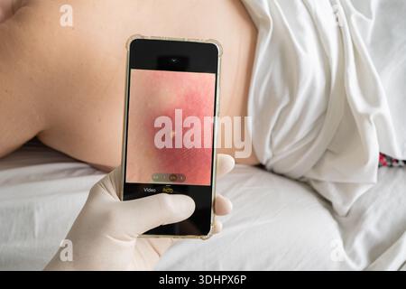 Ein Arzt macht Fotos mit einem Handy eines Maulwurfs auf der Rückseite eines Patienten, der mit der Seite nach unten auf dem Untersuchungstisch liegt Stockfoto