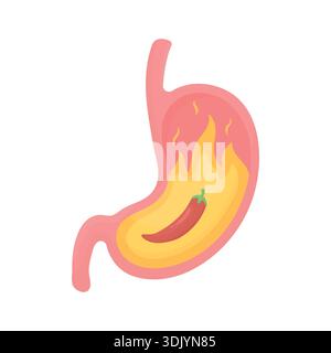 Menschlicher Magen mit Sodbrennen. Saurer Reflux, Brennen und Verdauungsstörungen. Gastroenterologisches Problem, hohe Acidität Stock Vektor