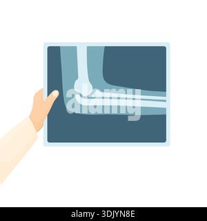 Ein Arzt in einem weißen Mantel hält ein Röntgenbild eines Ellbogens vor weißem Hintergrund. Konzept zur Diagnose von Knochenbrüchen und -Rissen. Elemente der Medizin Stock Vektor