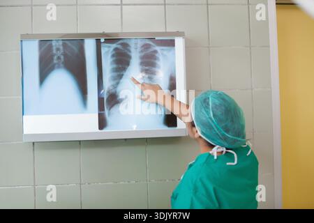Hintergrundbeleuchteter Leuchtkasten zeigt Röntgenaufnahmen der Brust an einer hellgrünen gefliesten Wand, einer hellgelben Tür. Radiologie, Röntgenaufnahmen, Peelings, Arzt, Krankenhaus, diagnose Stockfoto